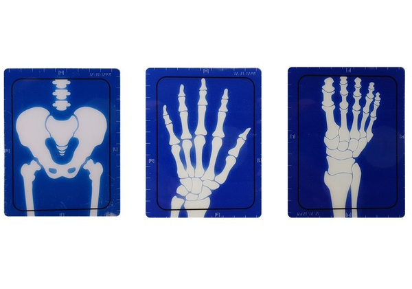 Medizinische Ausrüstung Medizinisches Zubehör Röntgenarzt